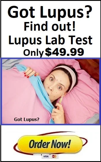 Lupus Test 49.99