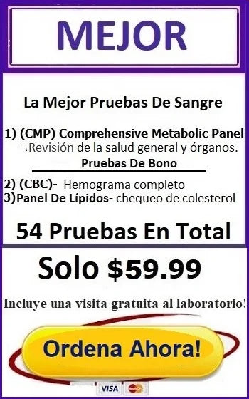 Prueba De Sangre Mejor