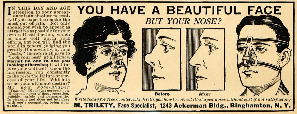 M. Trilety's Nose Shaper Model 25, a Wacky Beauty Treatment Used for Shaping  and Correcting the Nose From the 1920s ~ Vintage Everyday
