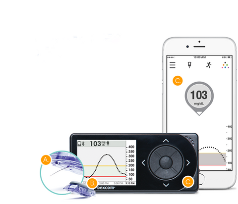 Continuous glucose monitoring (CGM) Dexcom G6 (transmitter and sensor)