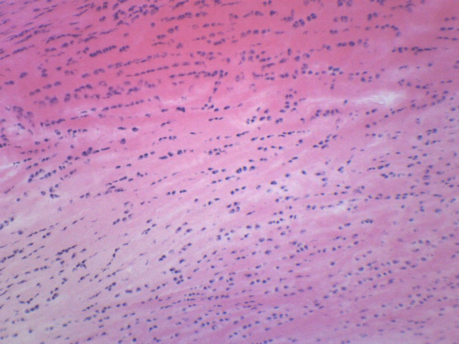 fibrocartilage