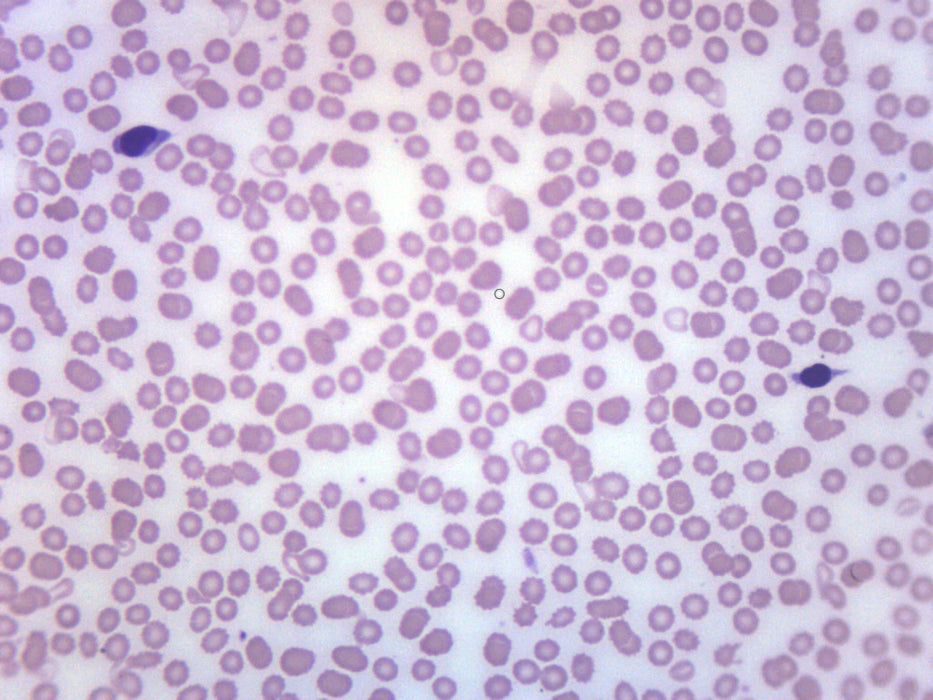 Human Blood Smear Wr Stain Prepared Microscope Slide 75x25mm Eisco Labs