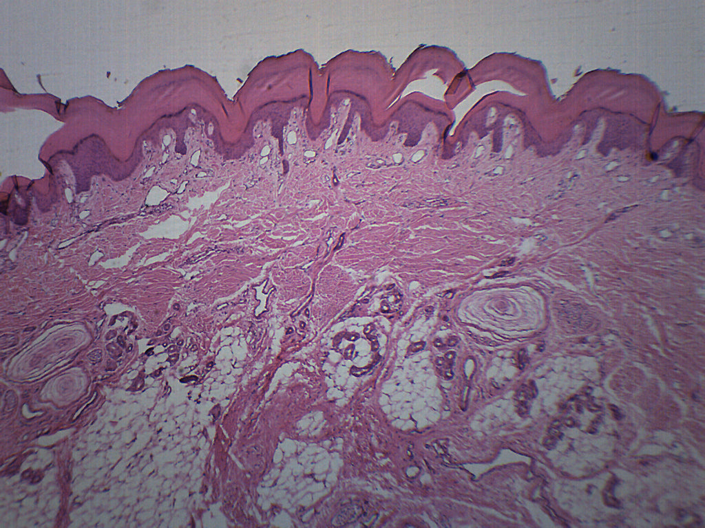 human skin layers microscope