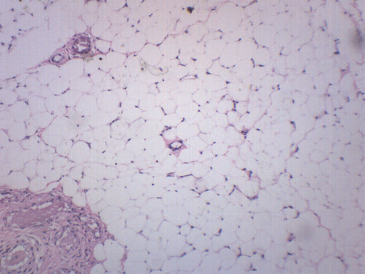 脂肪组织部分，人类 - 准备的显微镜幻灯片-75x25mm