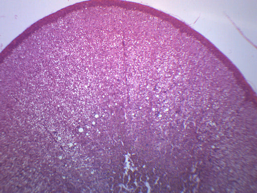 肾上腺 - 制备的显微镜幻灯片-75x25mm