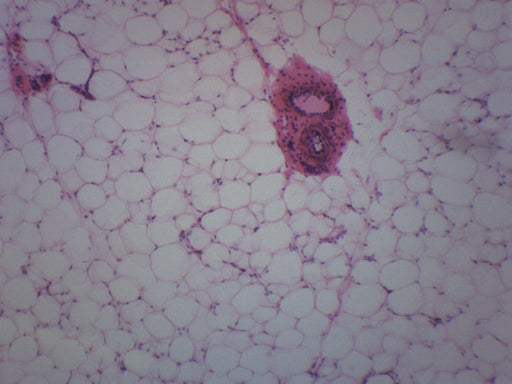 blastula slide