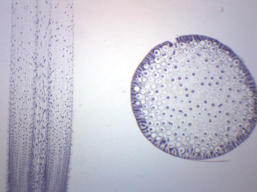 Ascaris和洋葱有丝分裂 - 准备的显微镜幻灯片 -  75x25mm