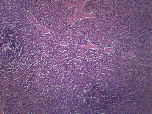 人脾脏部分 - 准备的显微镜幻灯片-75x25mm