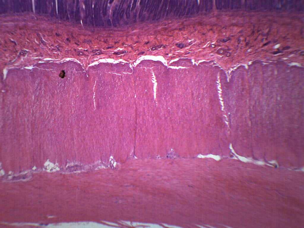duodenum slide labeled