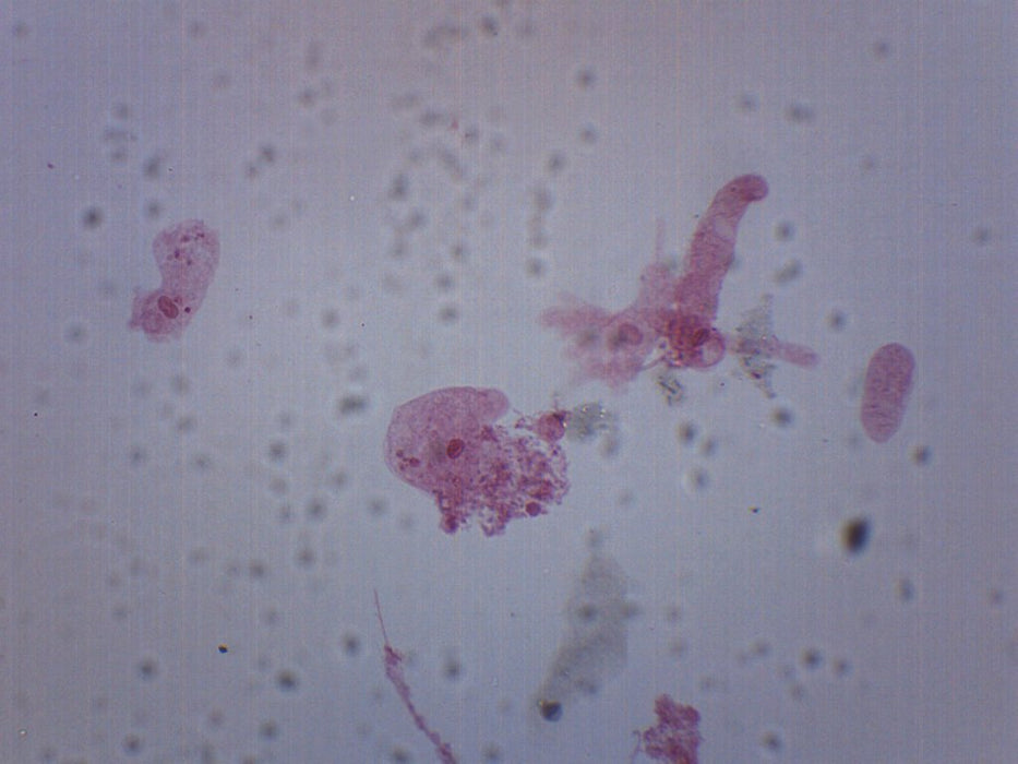 amoeba proteus