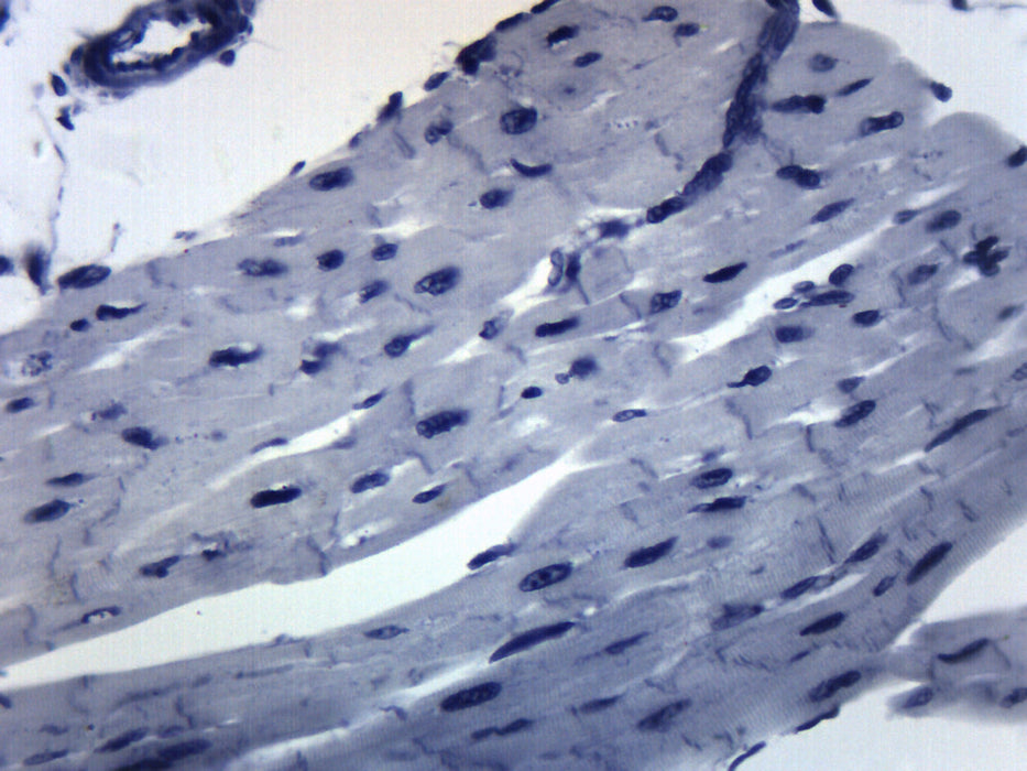 cardiac muscle slides