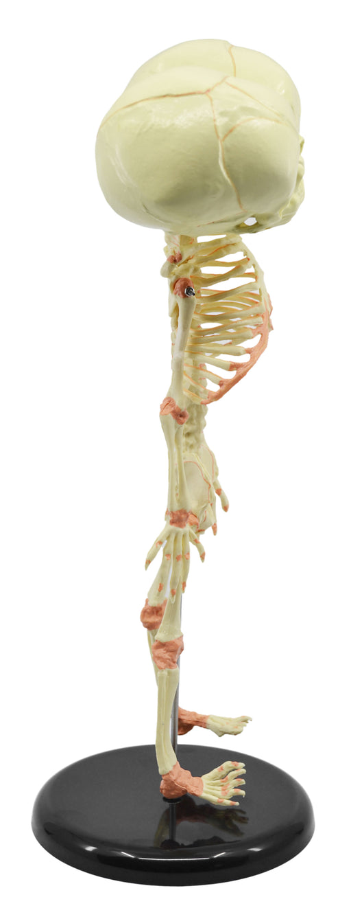 婴儿胎儿骨骼模型，迷你尺寸-双胞胎，连体头骨-安装杆-解剖学研究的不可思议的细节-埃斯科实验室欧宝体育官网进入