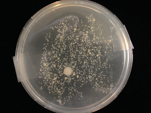 Untreated bacteria from toilet - hydrogen peroxide cleaning experiment
