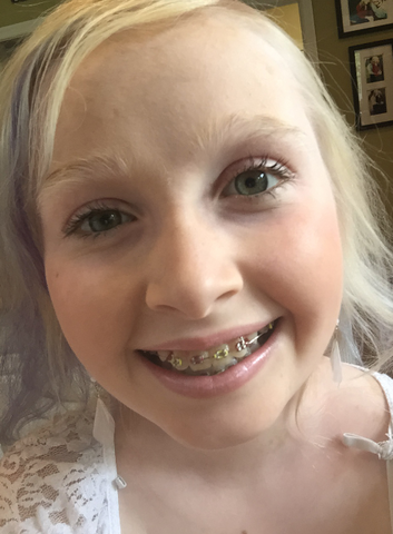 Bonnie Collin's daughter, Maya with braces