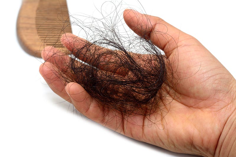 How Much Hair Loss is Normal? – Kerotin