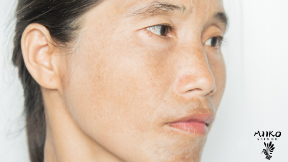 Asian woman waring no makeup is looking off camera, shot against a white background