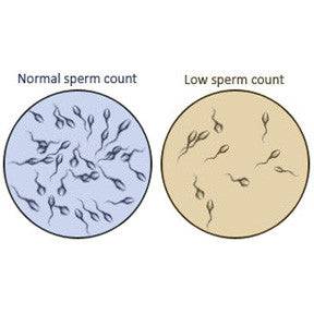 A low sperm count is called oligospermia, and an absence of sperm count is called azoospermia