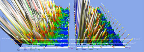 brainwave EEG frontal lobes - Sacred Acoustics