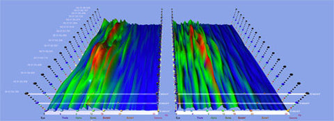 brainwave EEG frontal lobes - Sacred Acoustics