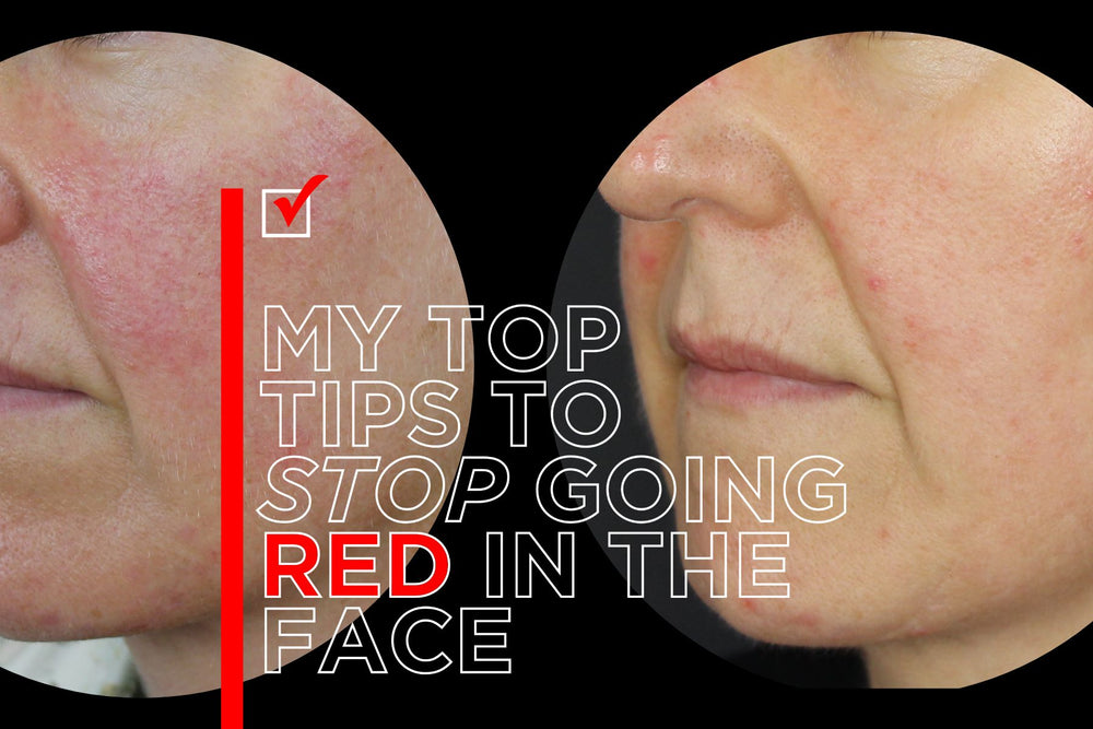 Top Tips To Stop Going Red Face Dr Natasha Cook Cosmeceuticals