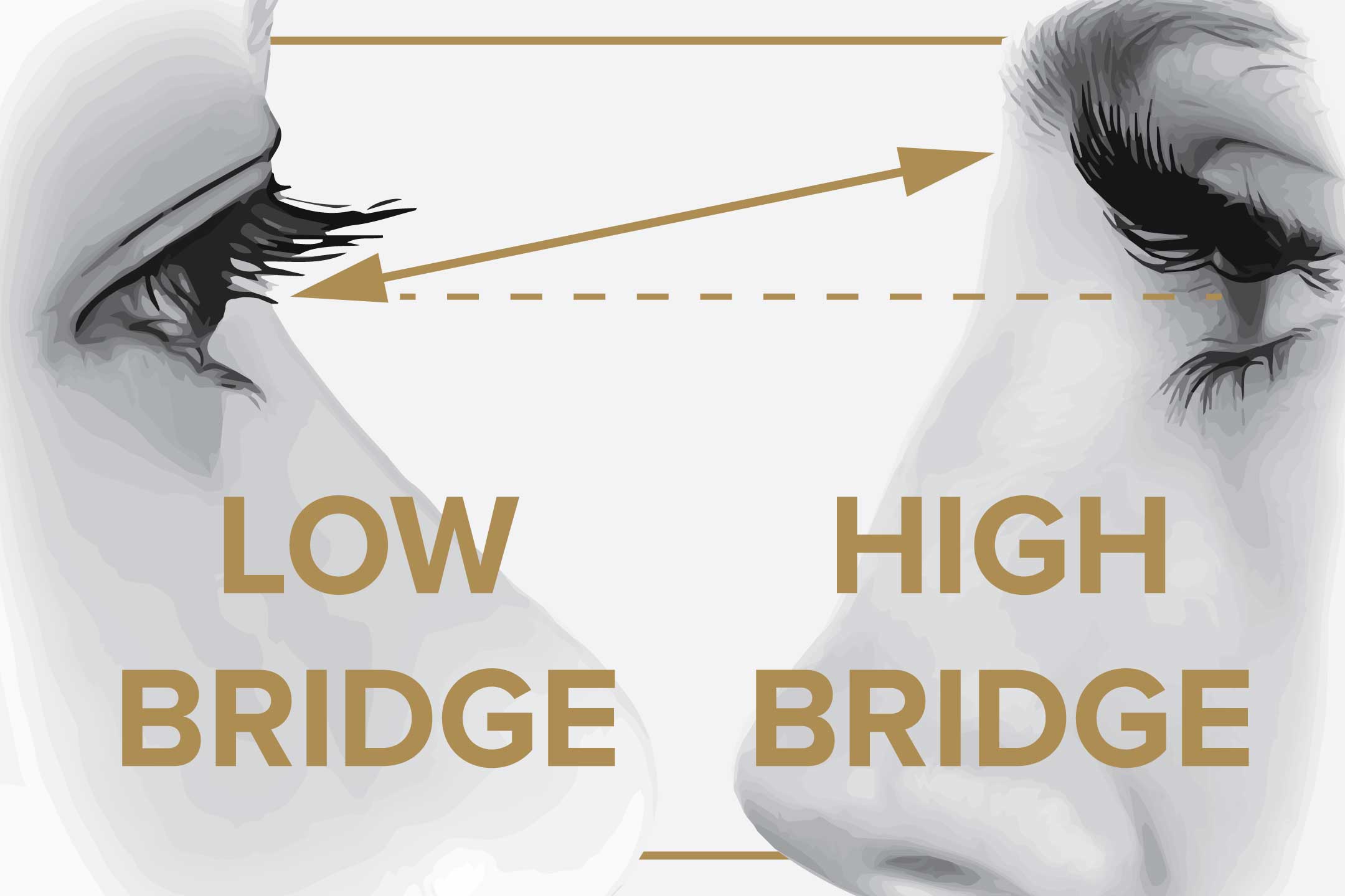 Illustrations of a low and a high human nose bridge