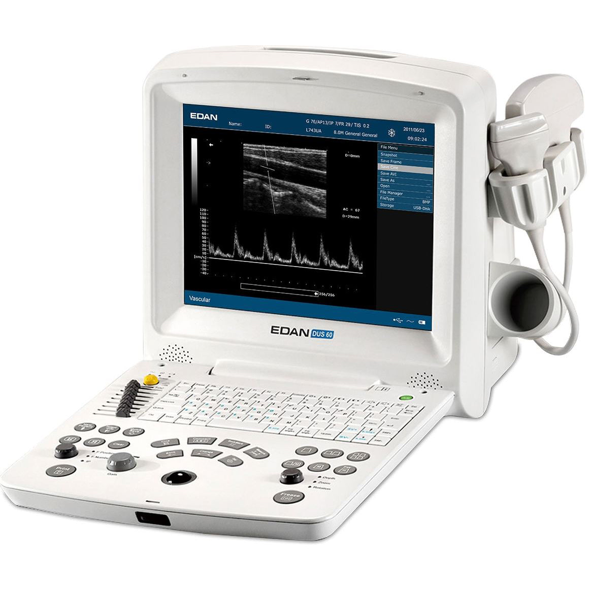 Edan DUS 60 Digital Ultrasonic Diagnostic Imaging System