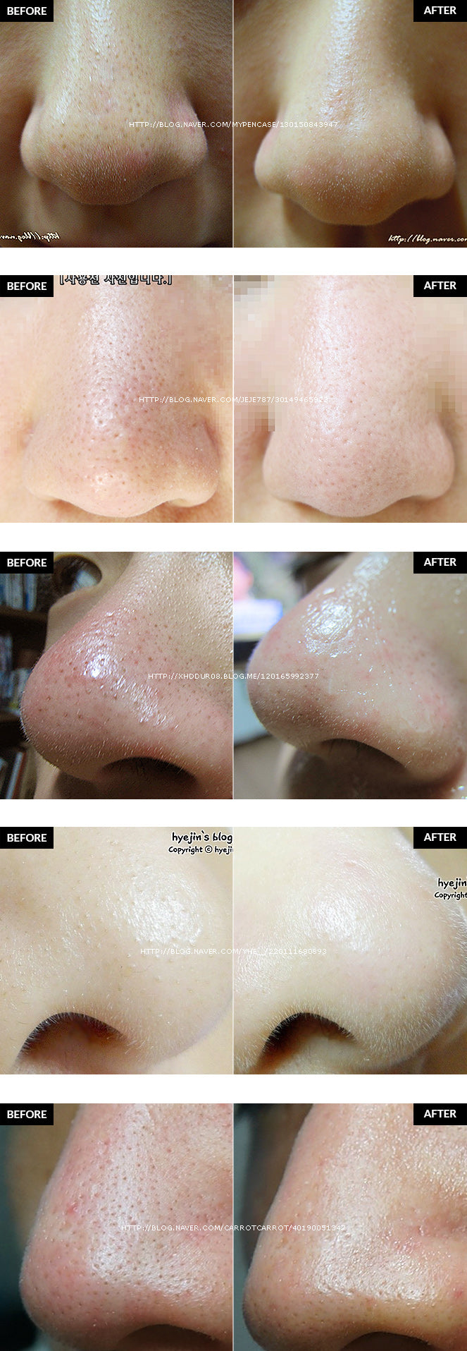 Skinmiso - Pore Beauty Nose Pack (Blackhead)