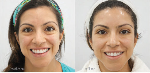 Ultimate-Eye-Corrector-BeforeAfter