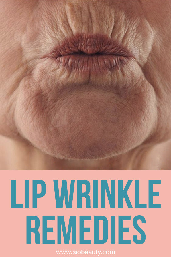 upper lip wrinkles