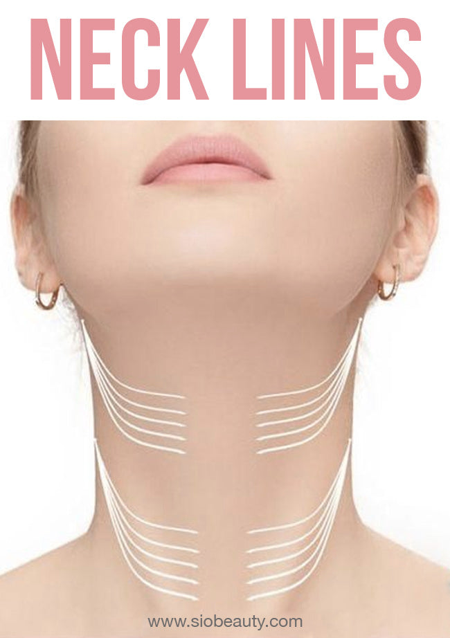 why do i have lines on my neck - Pregnancy Informations