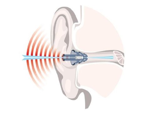 La musica è un piacere. Proteggi il tuo udito!