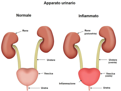 cistite infiammazione infezione vie urinarie rimedi cause cure