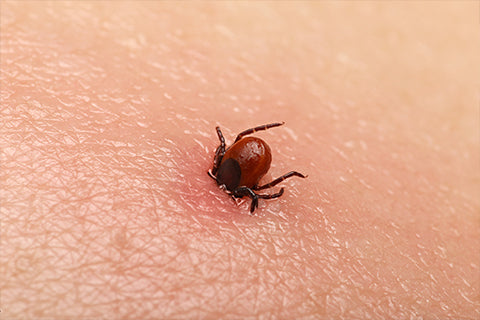 How You Can Safely Remove Ticks of All Sizes and Types