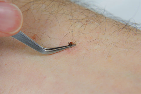 Mechanical removal is the only safe and effective way to remove a tick. – TRUE