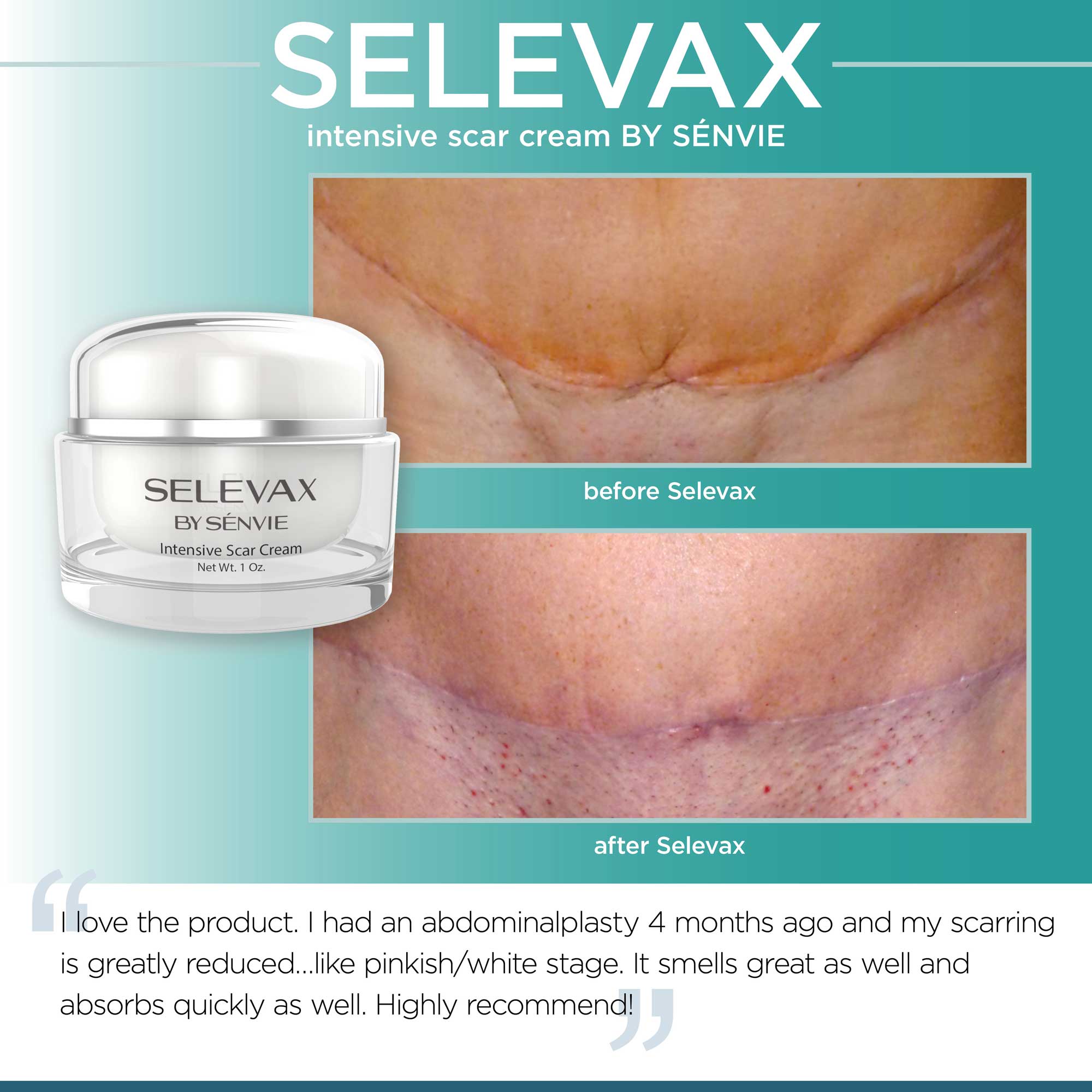 Selevax Surgery Scar Before and After Photo