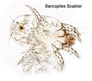 What are scabies?