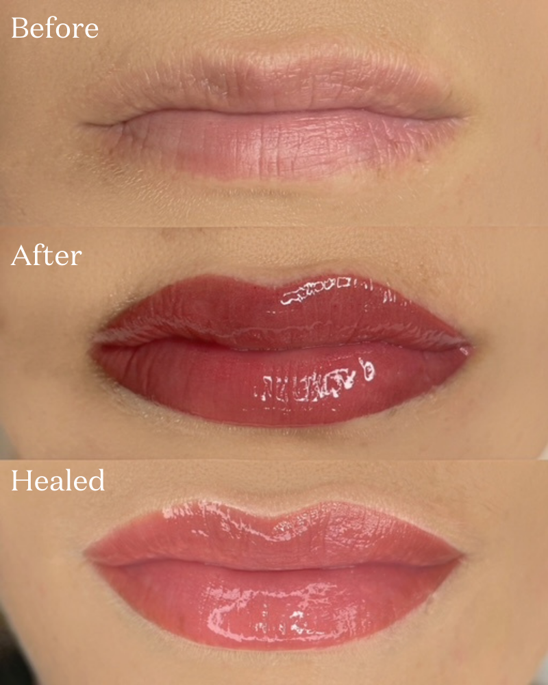 Lip Magic Online Course Lip Blushing Case Study using Magnum Needle Cartridges 