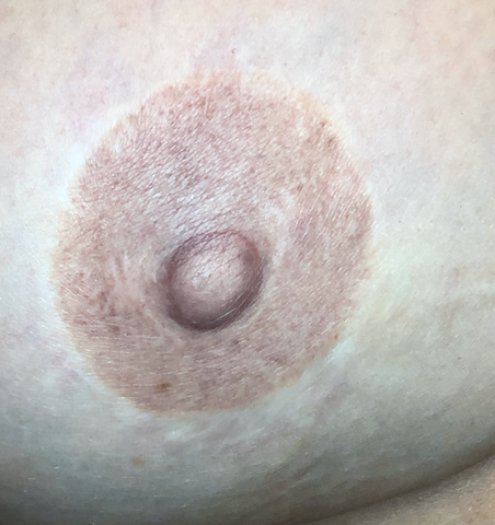 Areola Tattoo Healed Results by Jill Hoyer