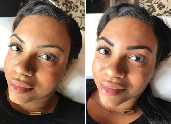Amber Before and Immediately After Results