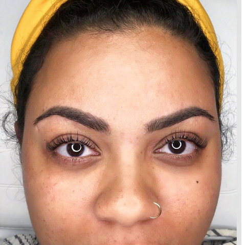 Amber's Healed Results 13 Months in Ebony by Tina Davies