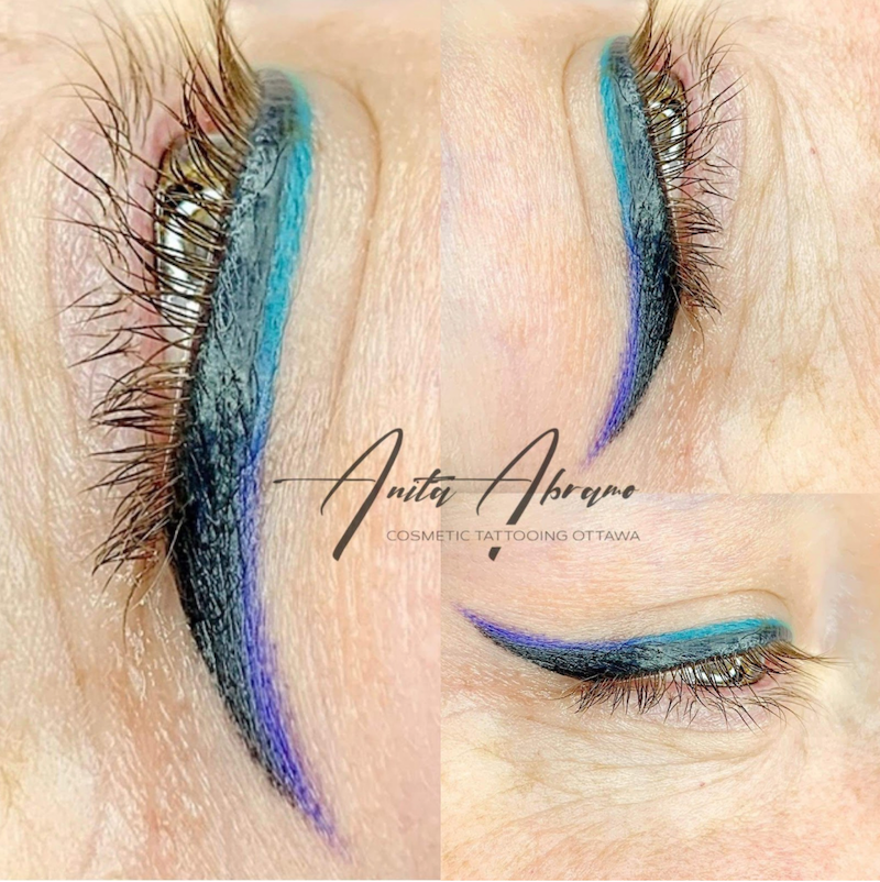 Anita Abramo Case Study Innovative Colorful Eyeliner Procedure PMU Healed Results