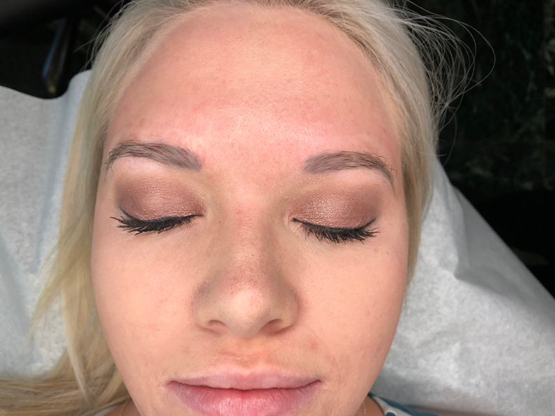 Ashy Brow Colour Correction Case Study Before Image