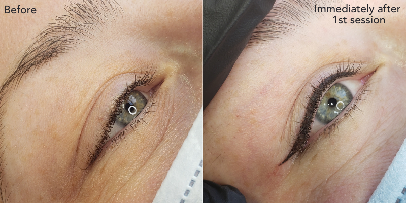 Case Study: Manual Eyeliner Outline Technique Before and After Images