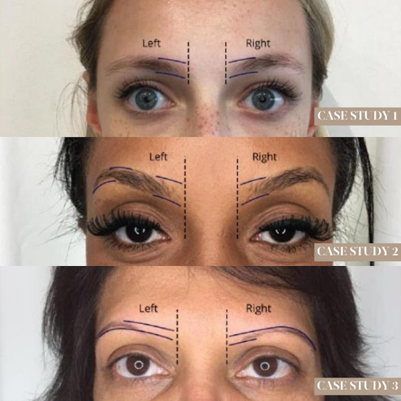 Brow Mapping Online Course Case Studies Chapter on The Collective by Tina Davies