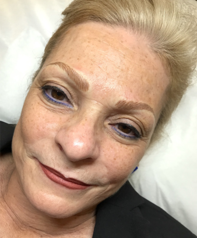 Tina Davies Case Study Microblading Results Immediately After Procedure on Mature Skin