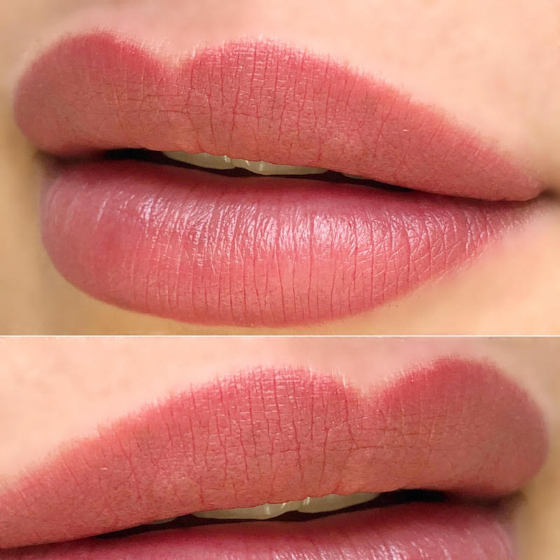 Case Study Healed Lips 