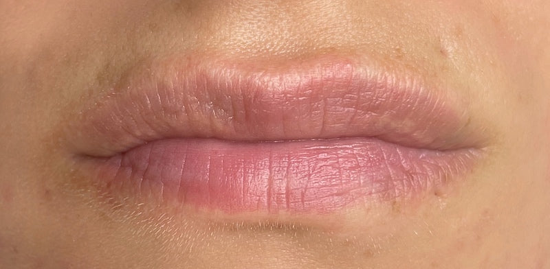 Lip Magic Lip Blushing Case Study Before Lip Procedure 