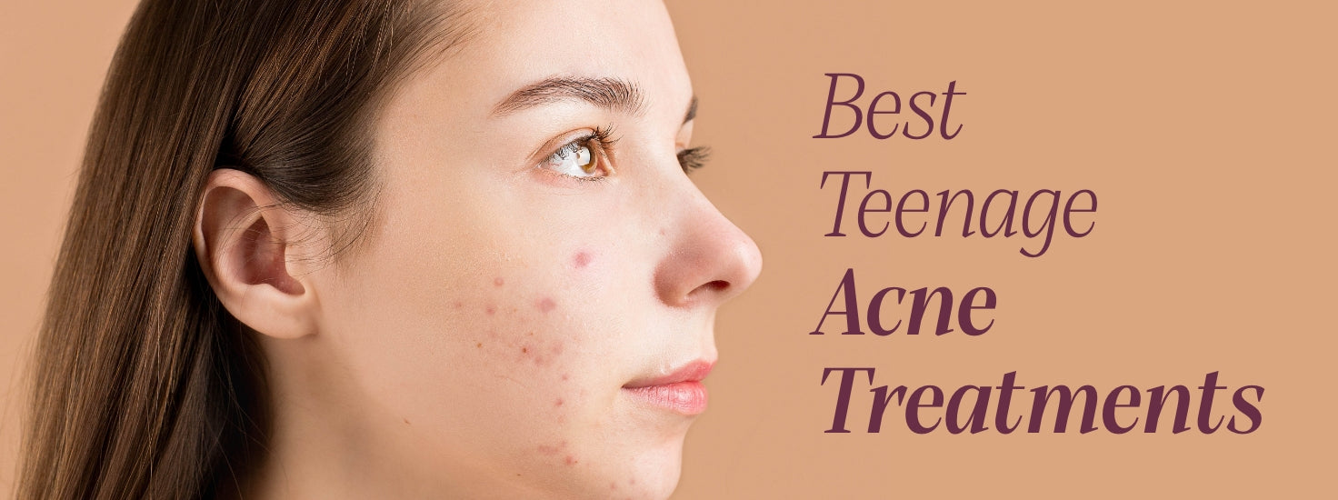 best acne treatment for teenage girl home remedy for acne australia