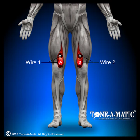 electrode pad placement for vastus medialis