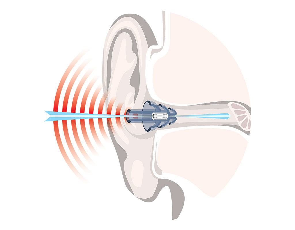 plug in noise filter